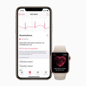 Apple-iPhone-watch-ecg-de-screen-03272019_big.jpg.large Apple Watch Ultra 2 ECG feature shown alongside an iPhone Health app screen displaying an electrocardiogram waveform and heart rhythm result.