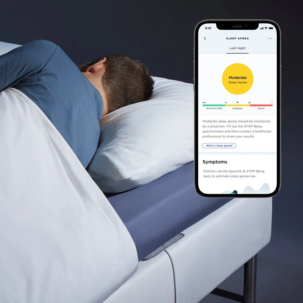 bedside-sleep-monitor-sleep-apnea-detection Bedside sleep monitor tracking breathing patterns and sleep apnea risk without body contact