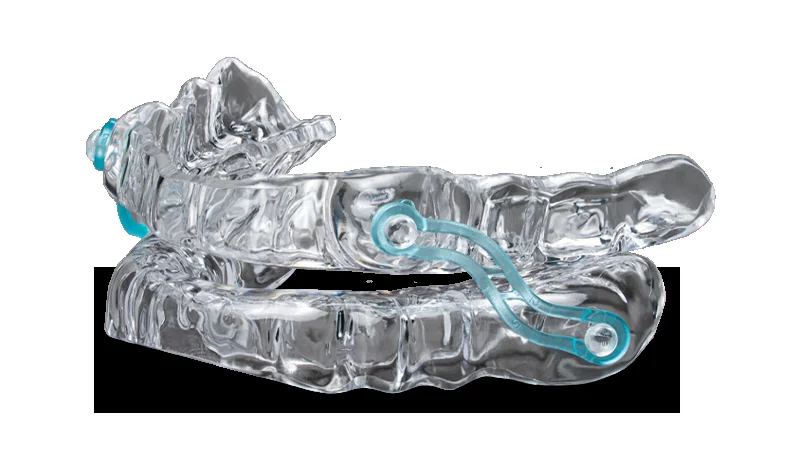 mandibular-advancement-oral-appliance-sleep-apnea Mandibular advancement oral appliance used to treat snoring and obstructive sleep apnea