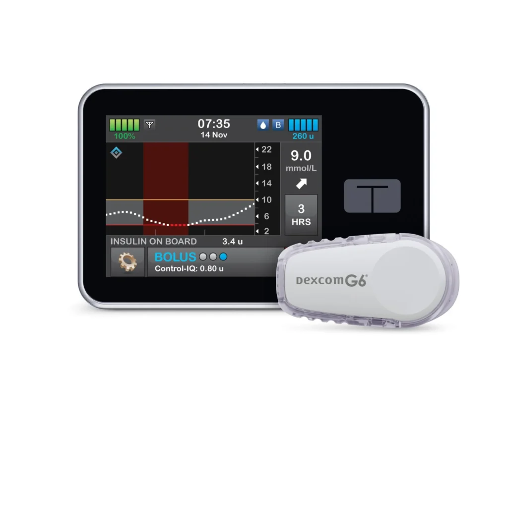 tandem-t-+-dexcom-g6-continuous-glucose-monitor Tandem T + Dexcom G6 continuous glucose monitoring system showing blood glucose trends on display with sensor device