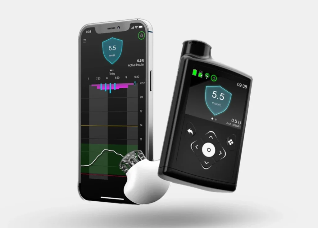 medtronic-guardian-4-insulin-pump-cgm Medtronic Guardian 4 smart insulin pump device with continuous glucose monitoring system and smartphone displaying glucose data