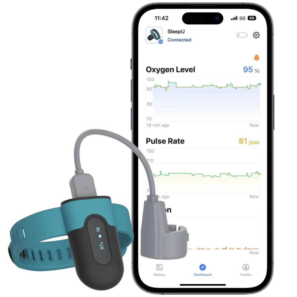 wellue-o2ring-oxygen-monitor Wellue O2Ring wearable oxygen monitor with mobile app tracking